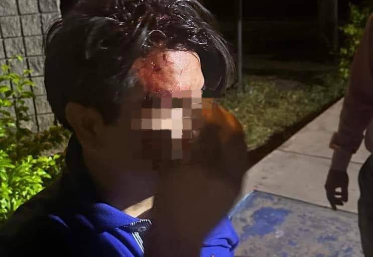 Manifestación en la UAdeO deja un herido y tuvo que intervenir la policía