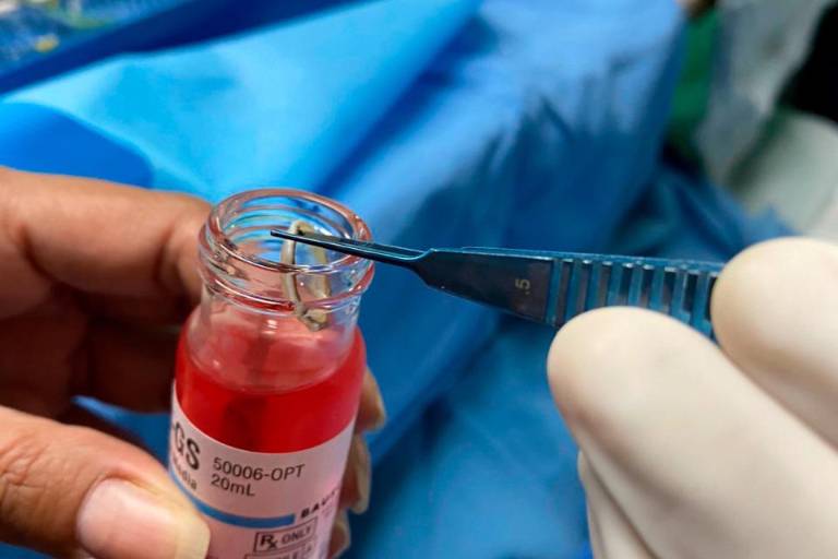 En el IMSS Mazatlán mujer dona sus córneas tras fallecer