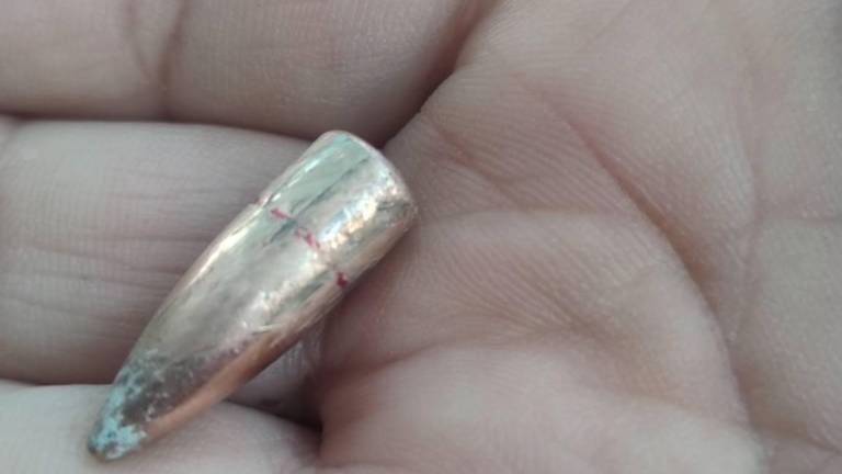 Vecina de la colonia Loma Bonita relató el momento de angustia que vivió luego de que una bala la impactara en el tobillo sin causarle lesiones graves.