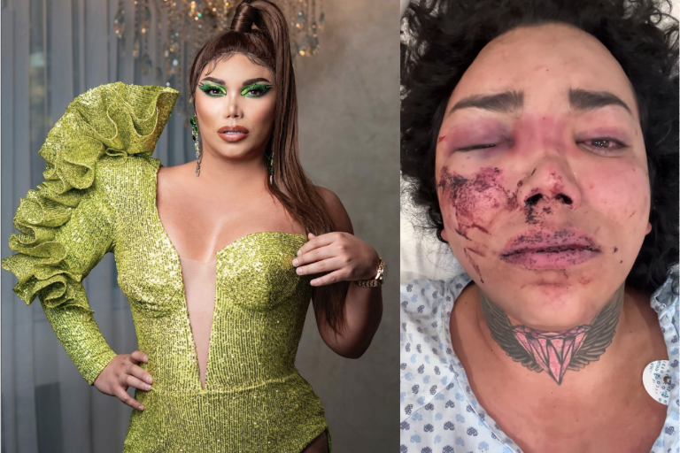 Sufre Paola Suárez, de ‘Las Perdidas’ agresiones de su pareja; podría perder un ojo