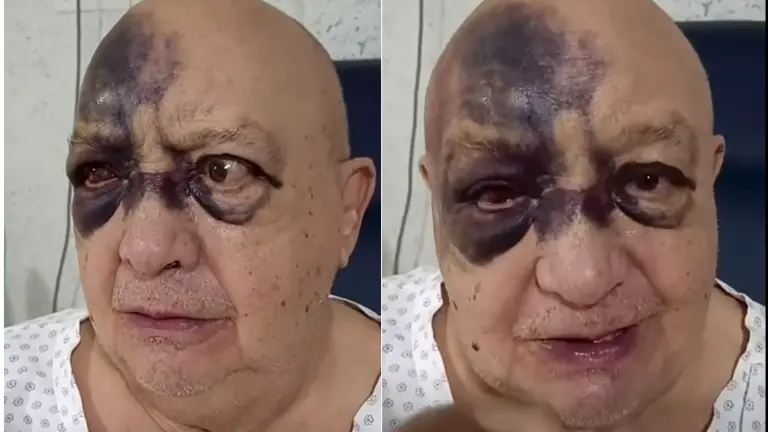 Luis de Alba sufre accidente en casa.
