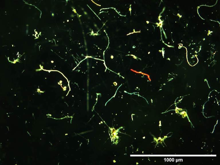 $!Colección de fragmentos de microplásticos, incluidas las microfibras.