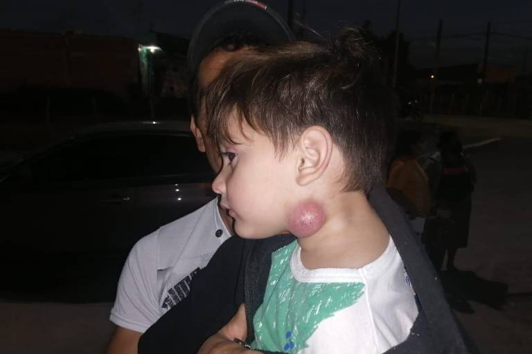 Desplazados de la zona sur por violencia exponen no tener servicios de Salud en el CVIVE