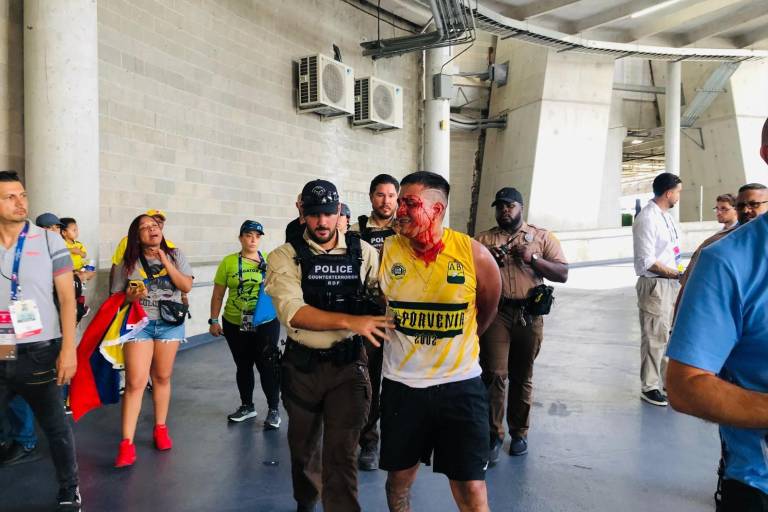 Se retrasa inicio de final de Copa América por desmanes en entrada de estadio