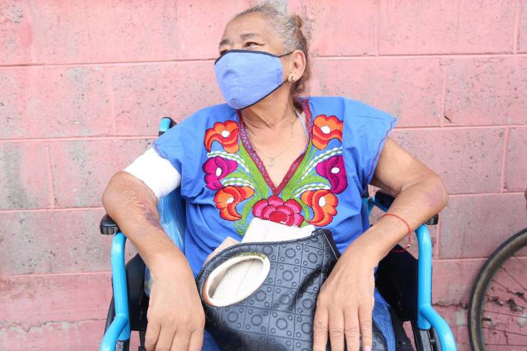 Daño colateral por la pandemia: Pacientes de hemodiálisis del IMSS denuncian que los ‘desplazan’ para atender a enfermos de Covid-19