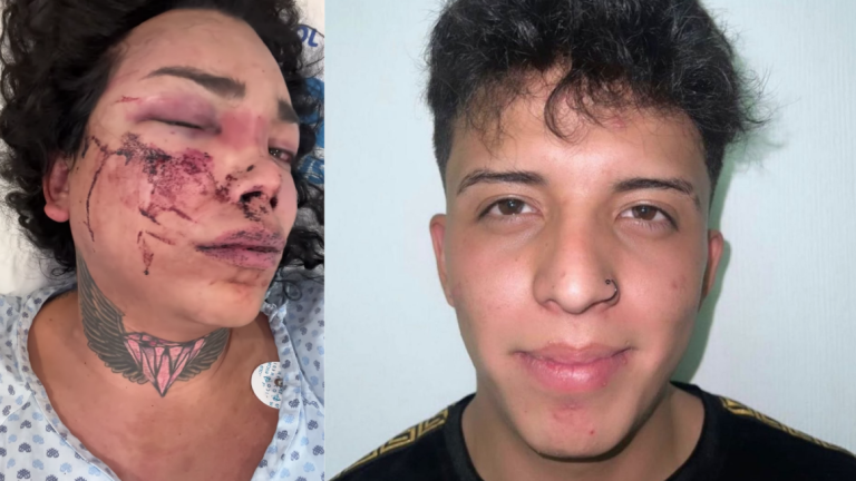 Responde pareja de Paola Suárez tras la agresión ‘andábamos drogados’