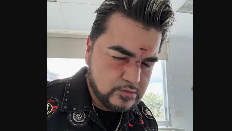 Luis Antonio “El Mimoso”.