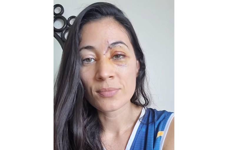 Sufre patinadora accidente al ser arrollada por scooter eléctrico en ciclovía del malecón de Mazatlán