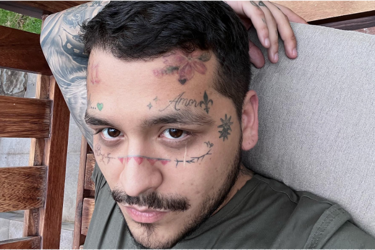 Muestra Christian Nodal su rostro tras realizarse costoso tratamiento para borrar sus tatuajes