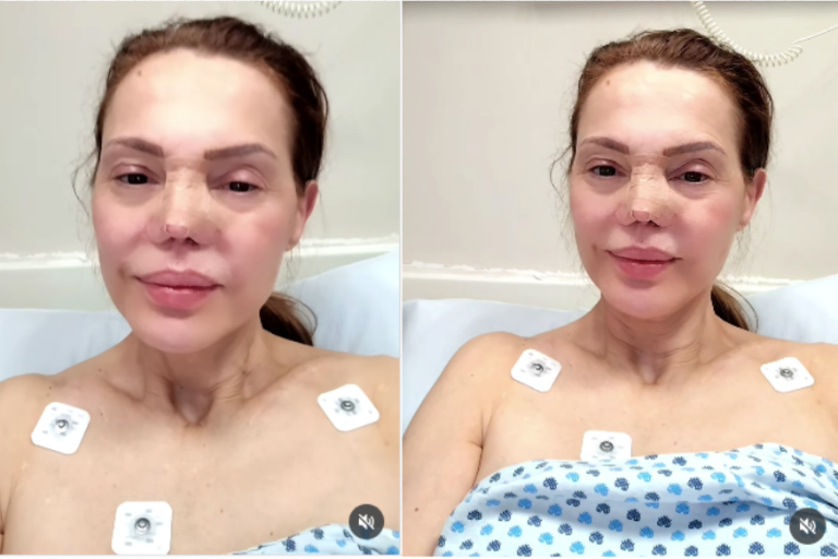 Tras accidente, hospitalizan a la modelo Carmen Campuzano