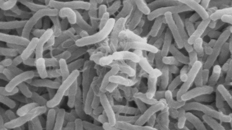 También se detectaron 20 casos sospechosos y al menos siete defunciones relacionadas con esta enfermedad.