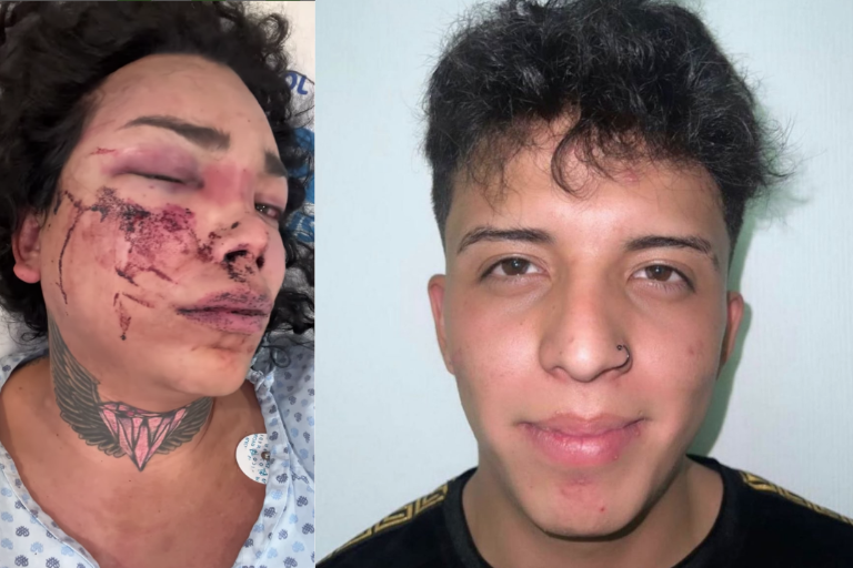 Responde pareja de Paola Suárez tras la agresión ‘andábamos drogados’