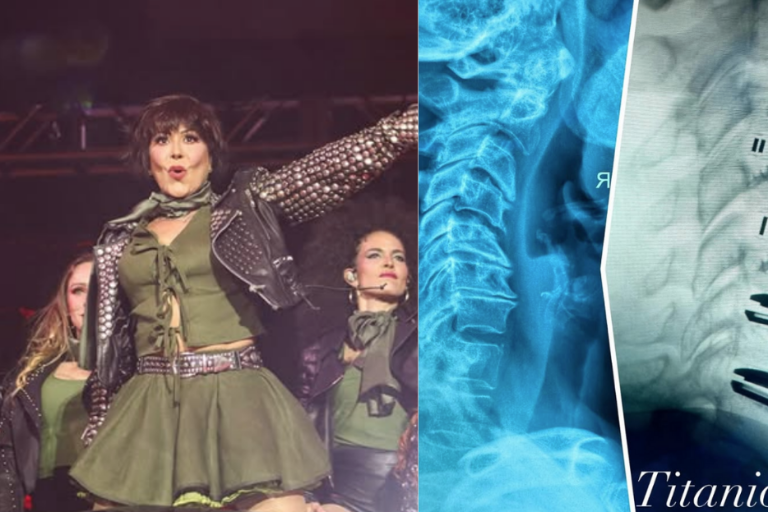 Muestra Alejandra Guzmán la radiografía de su columna tras delicada cirugía