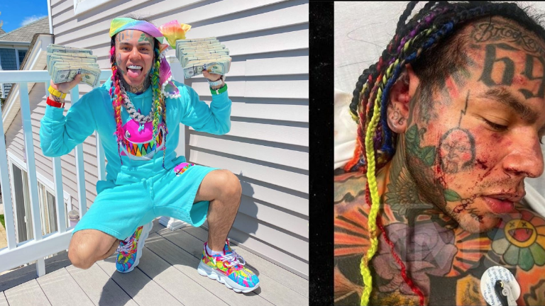 El rapero fue atacado mientras se encontraba en un gimnasio.