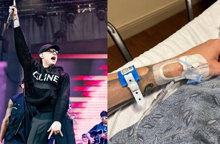 Operan a Peso Pluma tras su incidente en Nueva York, donde se torció el tobillo