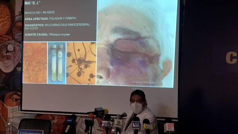 Fernando Muñoz Estrada, jefe del Servicio Dermatológico del Hospital Civil de Culiacán, informa sobre el hongo negro.