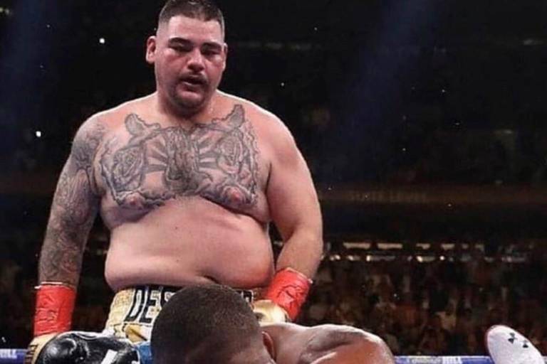 Andy Ruiz es operado de la rodilla, pero ya se recupera para pelear en diciembre