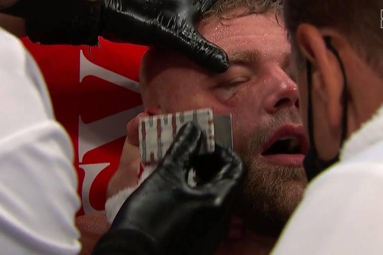 Billy Joe Saunders está ‘abatido’ tras caer ante ‘Canelo’ Álvarez