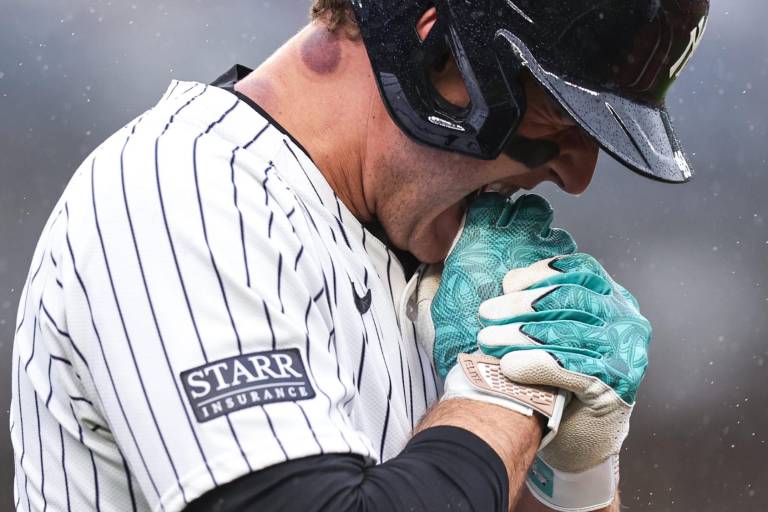 Rizzo sufre fractura en dos dedos; no lo descartan para la postemporada