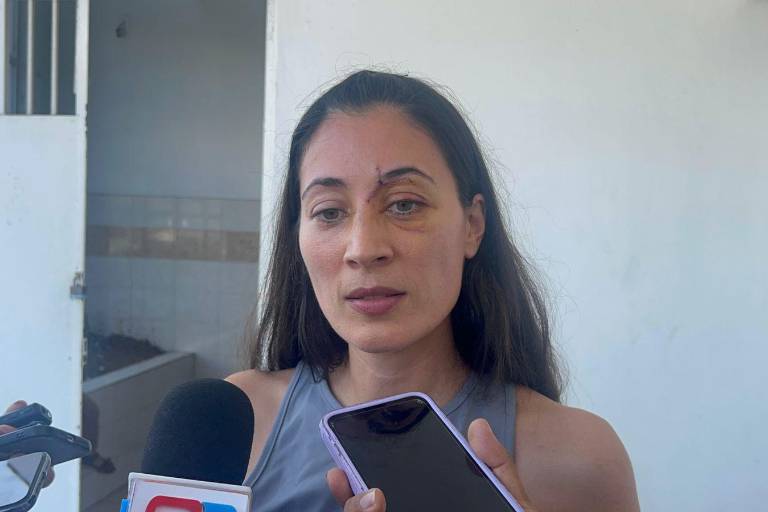 Joven española denuncia omisión de autoridades de Mazatlán tras sufrir accidente