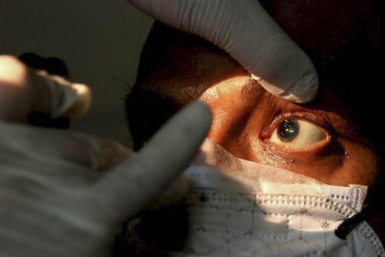 Con la pandemia del Covid se ha hablado también del hongo negro, pero, ¿a quiénes afecta?