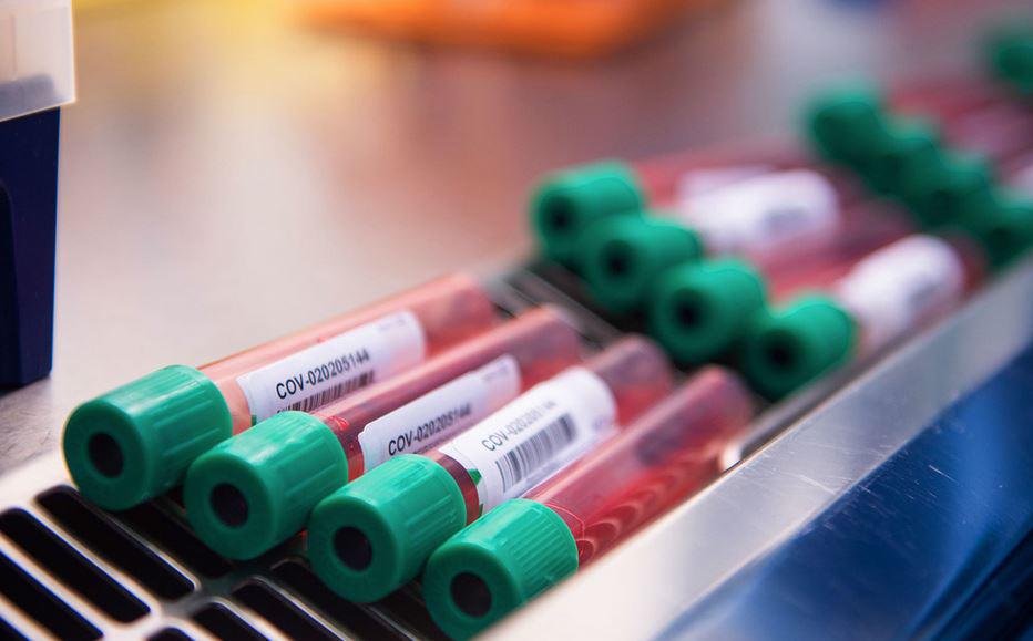 $!Un equipo científico de la Universidad de Oxford se encuentra en la fase de prueba de un proyecto de vacuna contra el Covid-19.