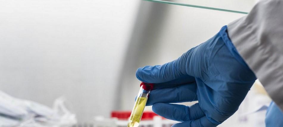 $!La OMS aprobó nuevas pruebas rápidas de antígenos que se están distribuyendo a nivel mundial.