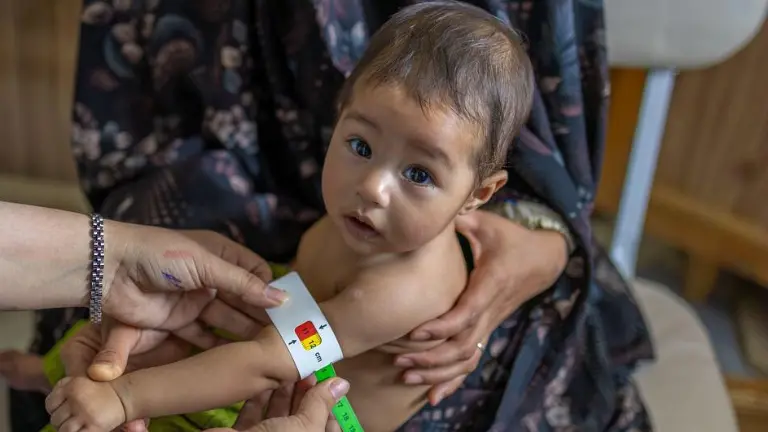 En una clínica de Herat, Afganistán, se examina a un bebé para detectar desnutrición.