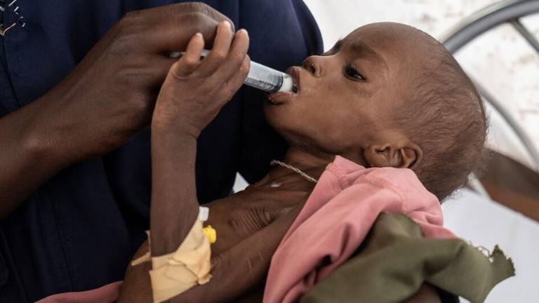 Una niña de tres años es tratada por desnutrición aguda severa en un hospital de Tawila, en la región de Darfur, Sudán.