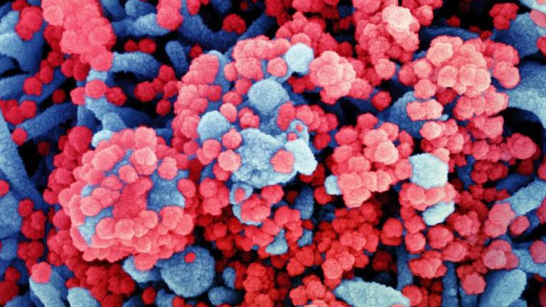 Micrografía electrónica de barrido coloreada de una célula (azul) muy infectada con partículas del virus SARS-CoV-2 (rojo).