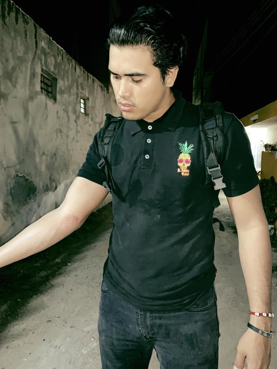 $!Ofrecen hasta $14 mil por cráneos humanos a youtubers; $10 o 5 mil por algún otro hueso