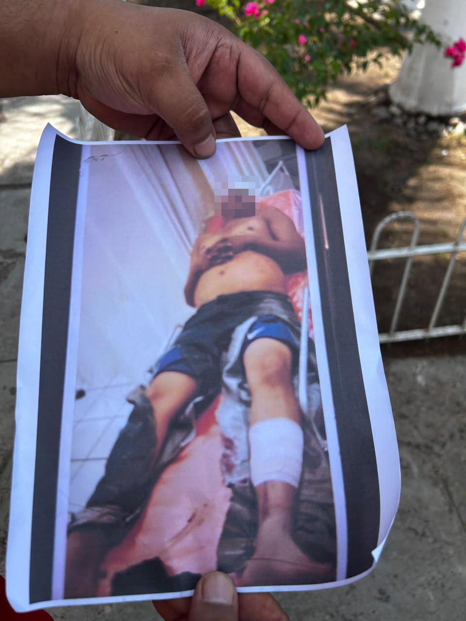 $!Habitantes de Villa Juárez denuncian abusos de corporaciones de seguridad; golpearon a un trabajador y lo dejaron amarrado en un hospital