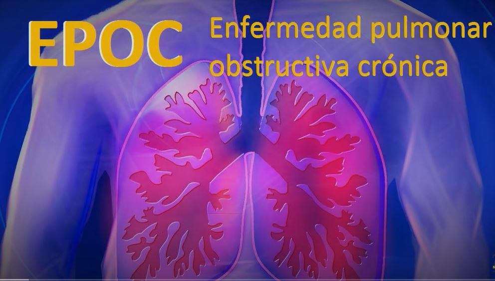 $!Millones de personas en el mundo mueren anualmente debido a la EPOC, afirma neumólogo